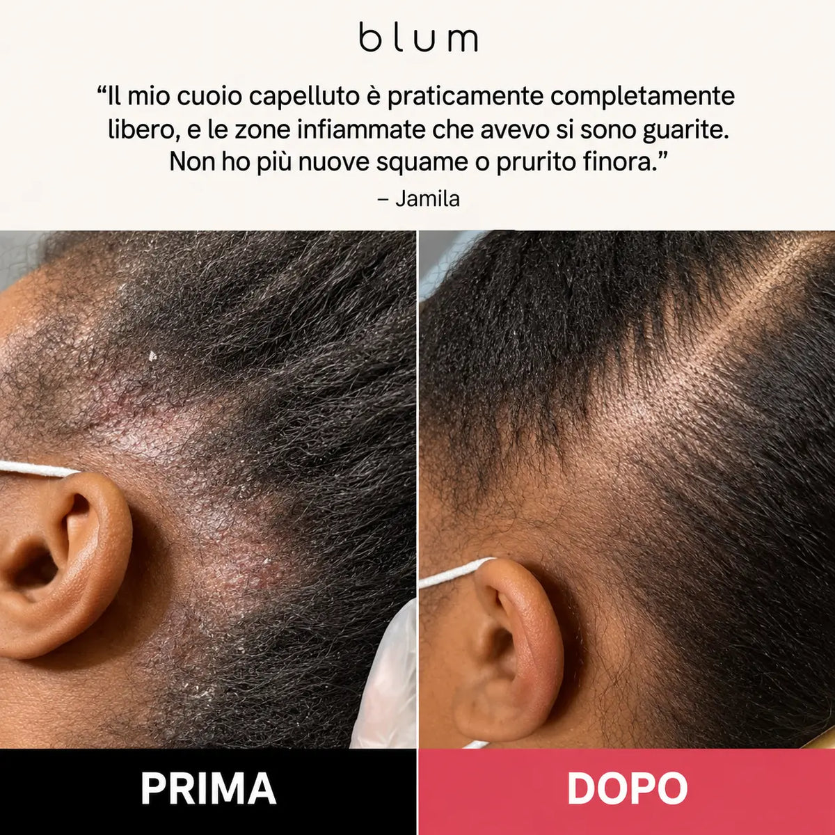Scrub Rinnova Cuoio Capelluto