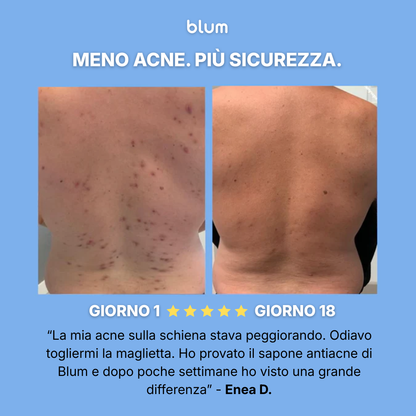 Sapone Purificante Anti-Acne™