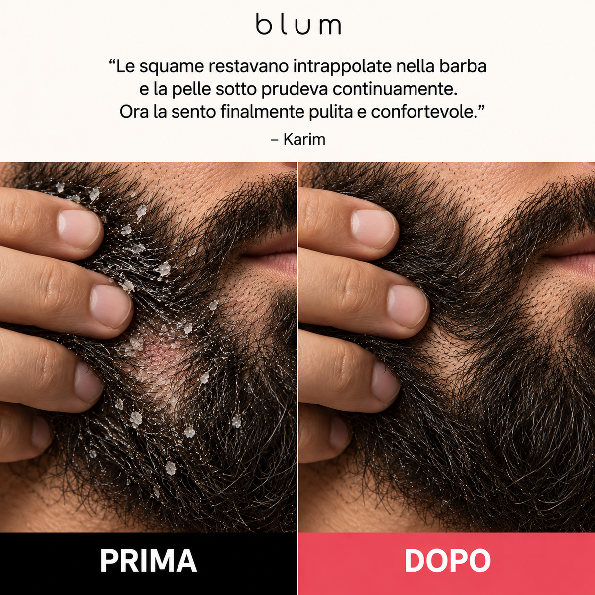 Scrub trattamento uomo