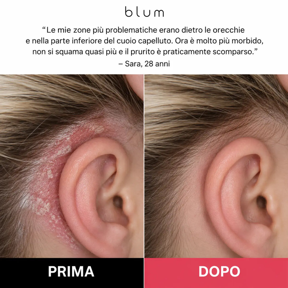 Scrub Rinnova Cuoio Capelluto