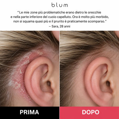 Scrub Rinnova Cuoio Capelluto