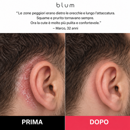 Scrub trattamento uomo